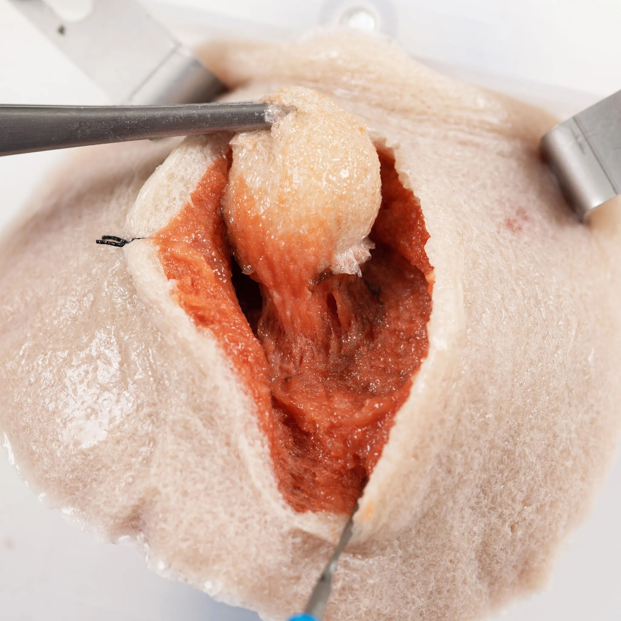 Composite Tumor Model